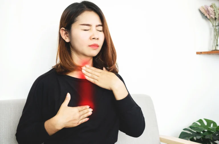 Acid Reflux (1)